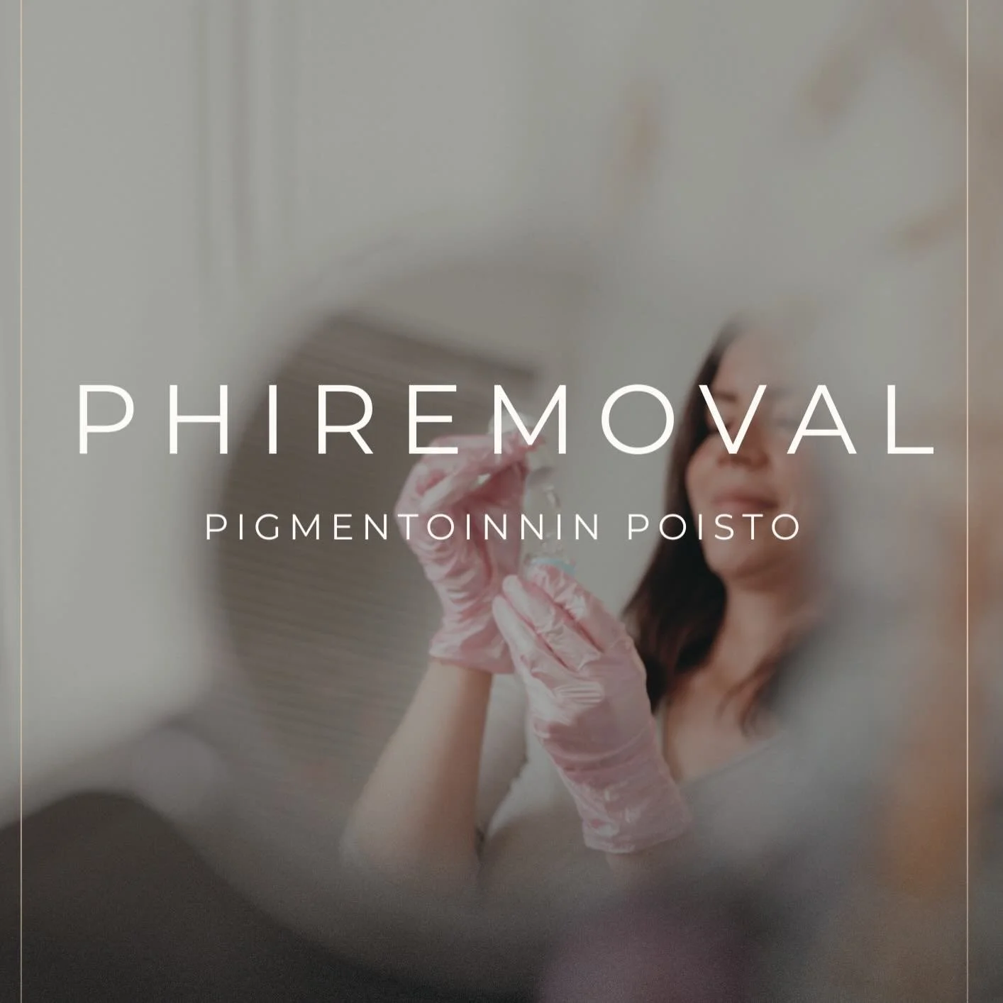 PhiRemoval pigmentinpoisto yhden k&auml;sittelykerran j&auml;lkeen🩵

Asiakkaalle on tehty aiemmin useampi laserpoisto, miss&auml; v&auml;ri&auml; ei ole en&auml;&auml; poistunut toivotusti. Tehtiin kulmiin pigmentinpoisto PhiRemovalilla ja saatiin h