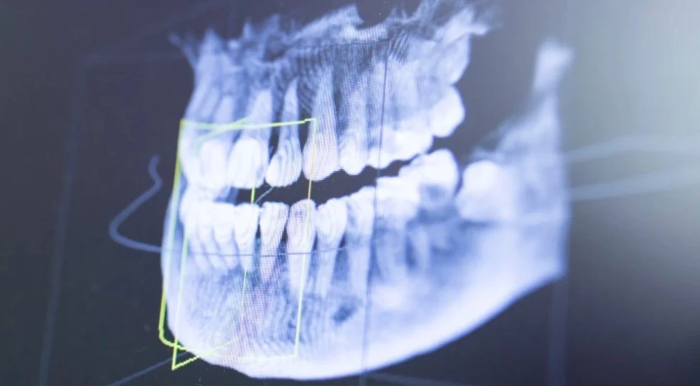 🦷 Important Read for Dental &amp; Health Professionals!

Check out this insightful article from Nature/British Dental Journal: &ldquo;Why should everybody care about special care dentistry?&rdquo; &mdash; it explores the vital role of Special Care D