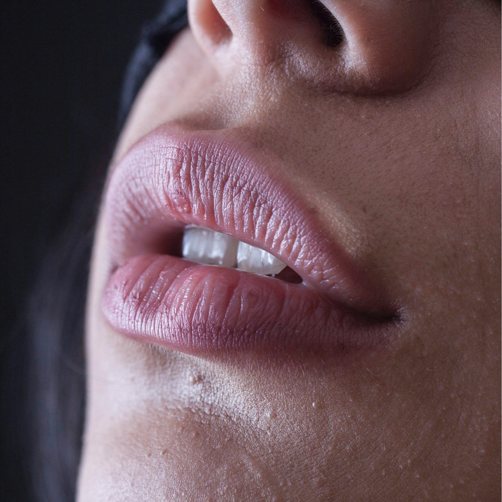 Women's lips, uplifted