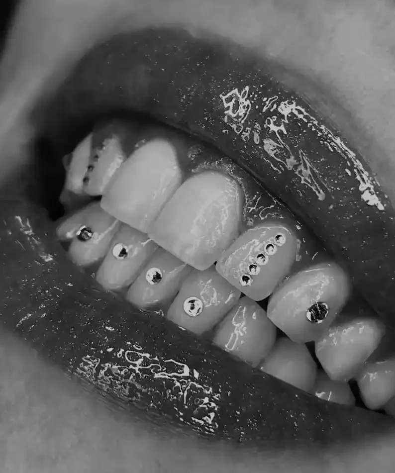 Close-up black and white photo of a mouth showing teeth decorated with multiple small rhinestones.
