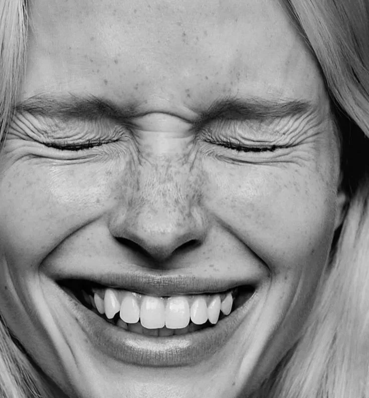Close-up black and white portrait of a woman laughing with a bright white smile after a teeth whitening treatment at Smile Bar Calgary.