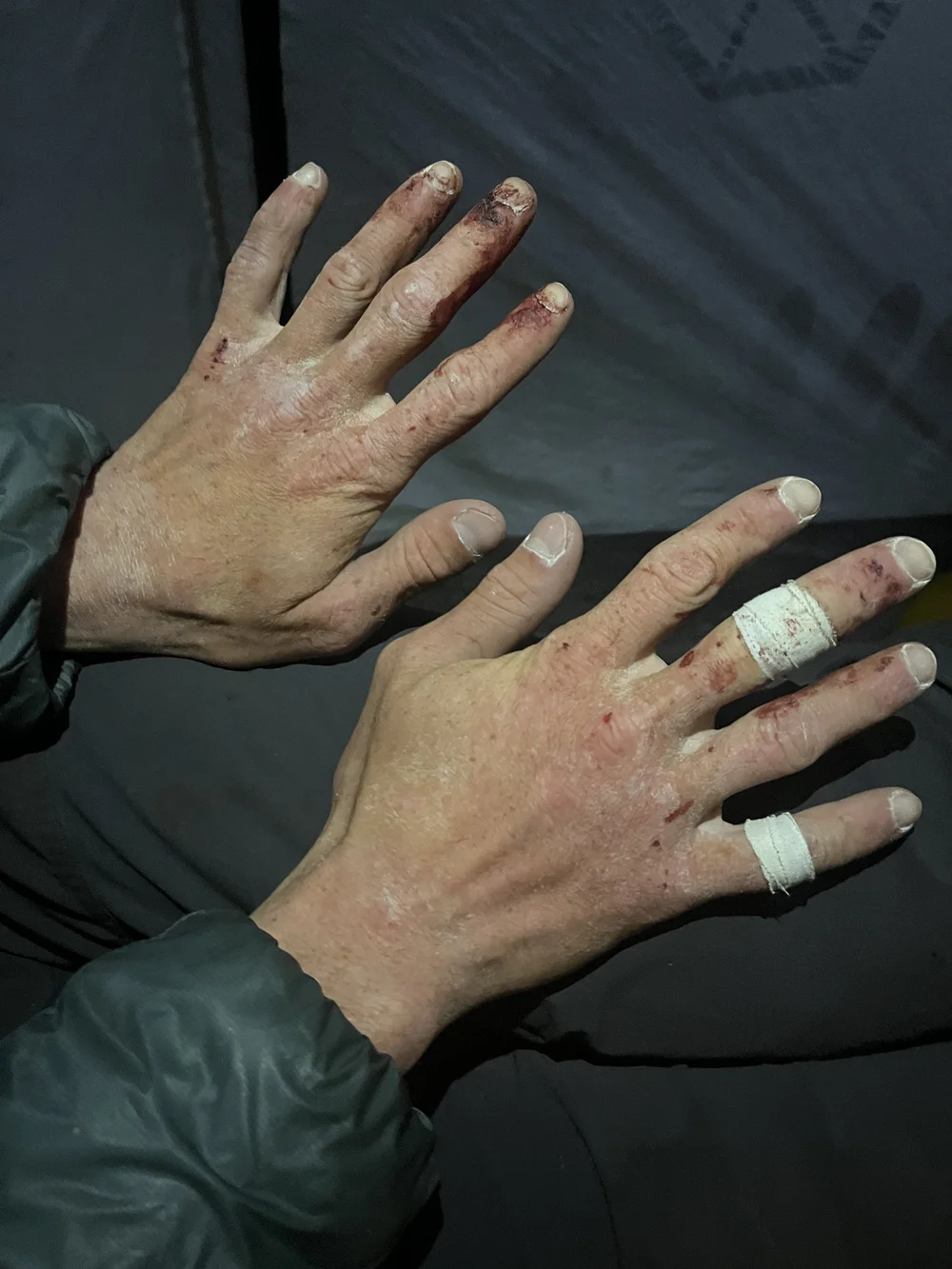 My hands after the day (Photo: Colin Haley)
