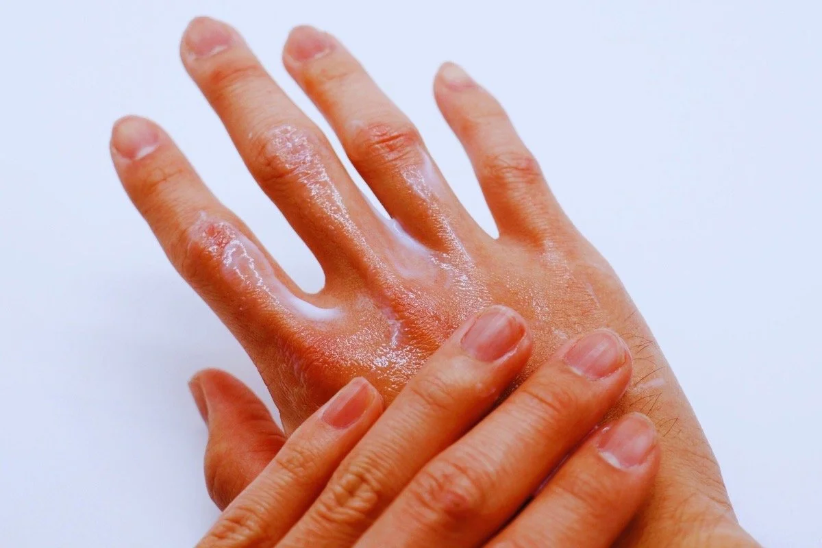 Applying a barrier-repair balm to dry, sensitive hands to prevent moisture loss