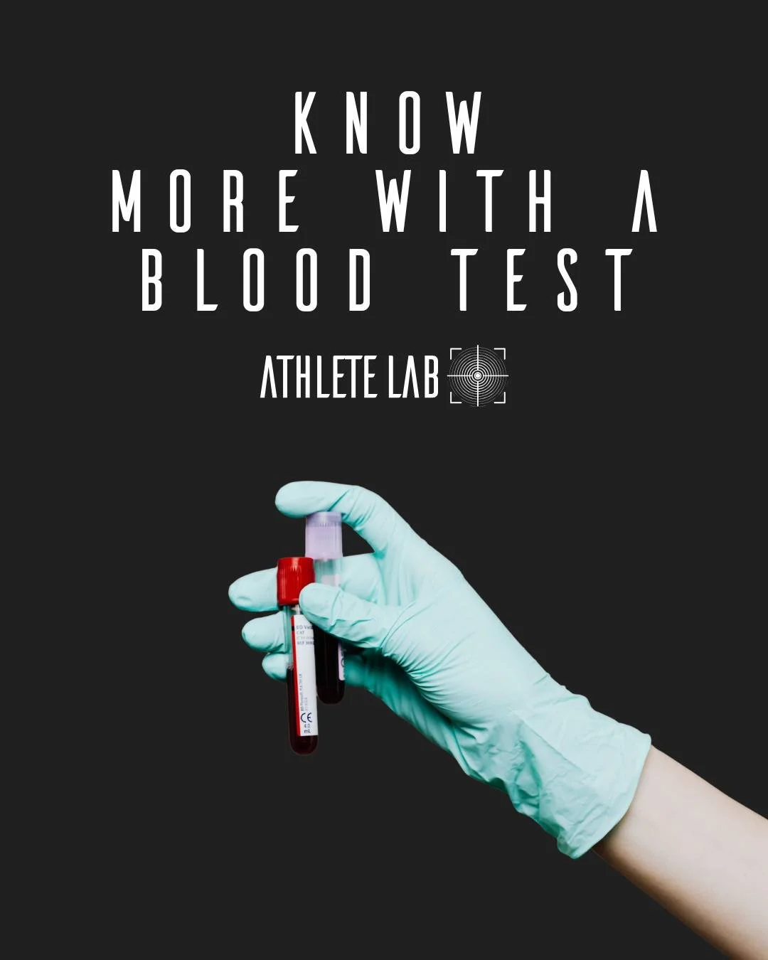 Take control of your performance from the inside out. 💪
At Athlete Lab, our Blood Lab service analyses over 50 key markers, from thyroid and hormonal health to liver, kidney and heart function, giving you the data-driven insight you need to optimis