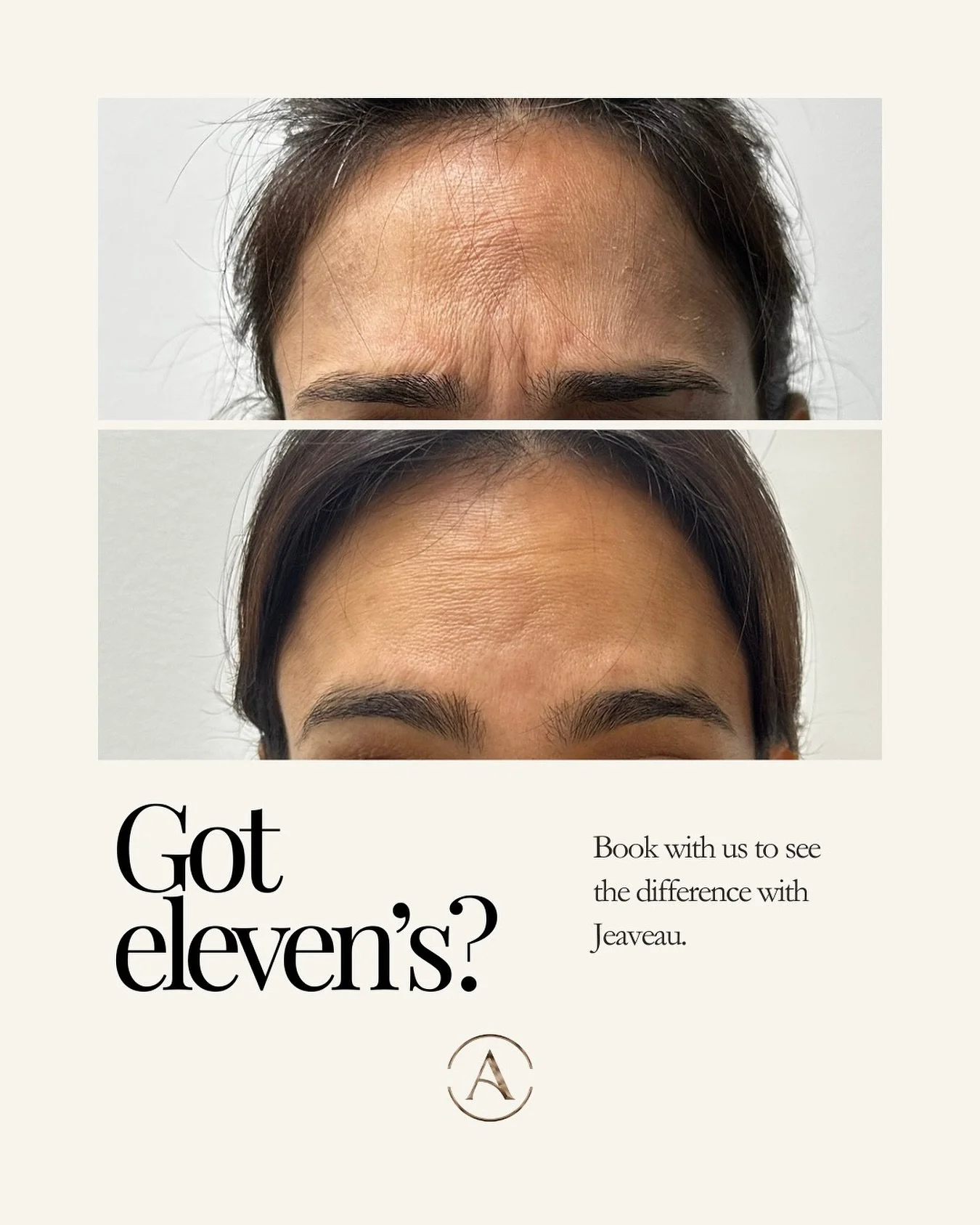 11/11! A day to make a wish&hellip; for smoother elevens.
 Subtle, natural refinement with @jeuveaubyevolus, a modern neuromodulator designed to soften frown lines while keeping your expression effortlessly you. 

Now booking in the DMV area. Discove