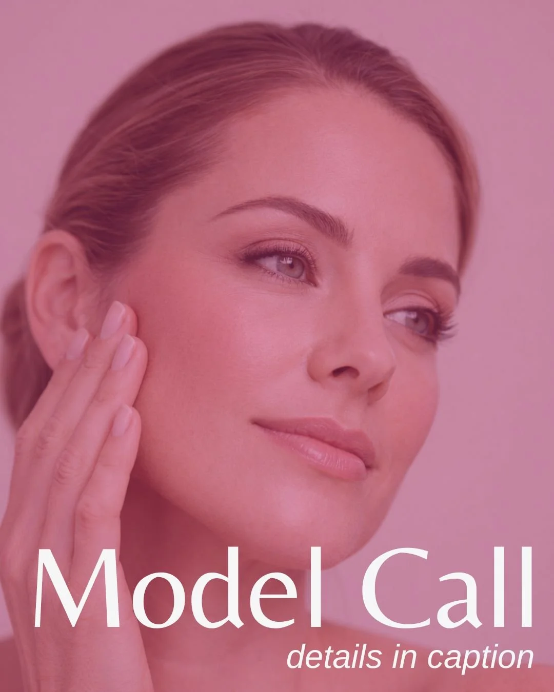 MODEL CALL: FREE MID FACE FILLER 😊
(think cheekbones / upper cheek)

We&rsquo;re offering a limited number of free filler appointments!

Treatment is provided under expert supervision with a focus on soft, natural results, in exchange for before &am