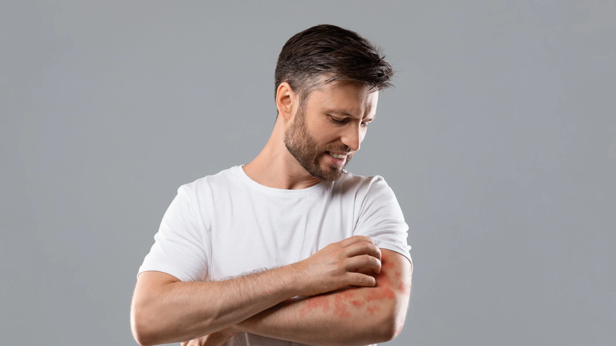 Allergische Reaktion. Ein Allergie-Check-up hilft, Allergien frühzeitig zu erkennen und individuelle Behandlungspläne für ein symptomfreies Leben zu erstellen.