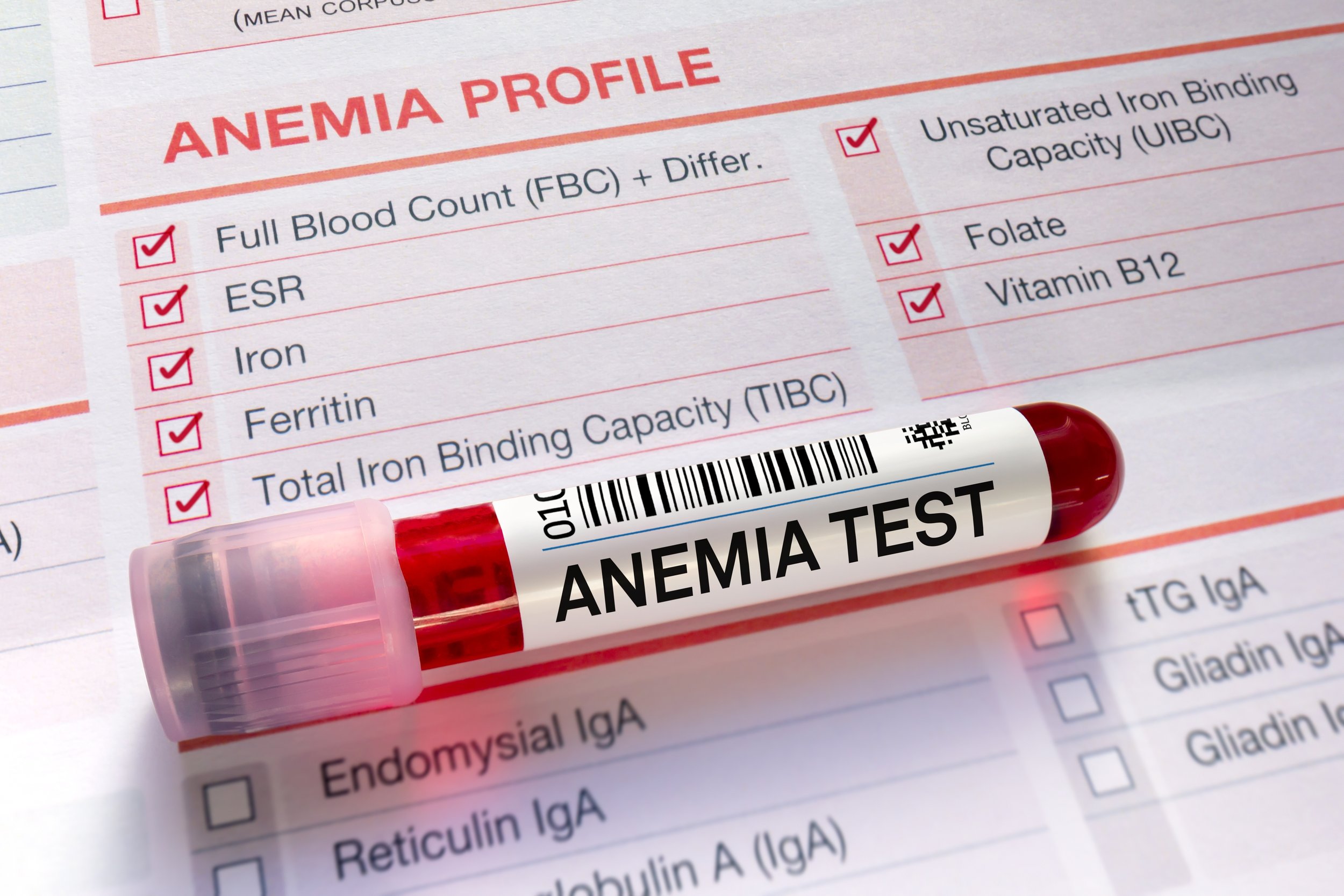 Ein Anemia Check-up hilft, Eisen- und Blutwerte zu überprüfen, um Anämie frühzeitig zu erkennen und gezielte Behandlungen zu ermöglichen.