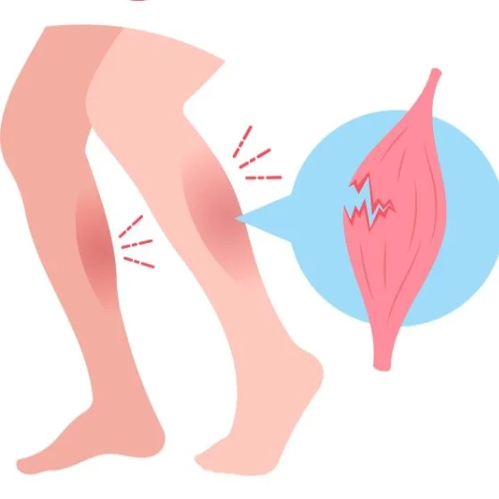 une élévation de la CPK (créatine phosphokinase) indique des lésions musculaires