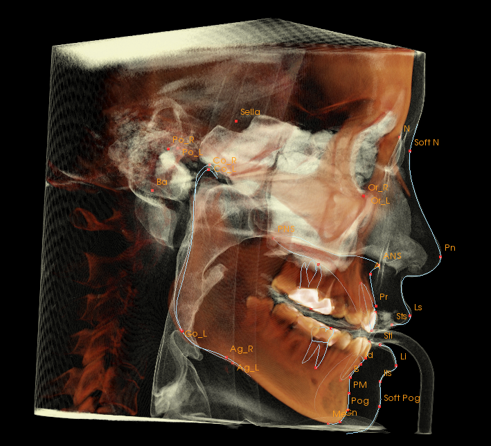 A detailed medical diagram of a human skull and jaw in profile, showing various labeled anatomical features.