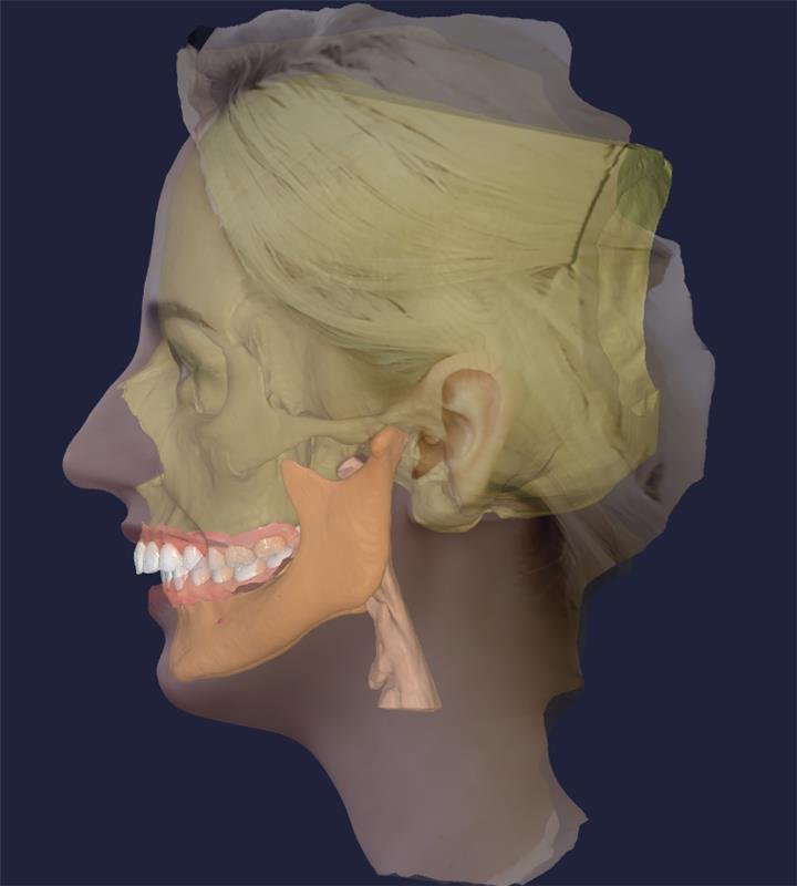 A layered anatomical illustration of a woman's side profile showing the skull, teeth, jaw, and sections of the ear and neck.