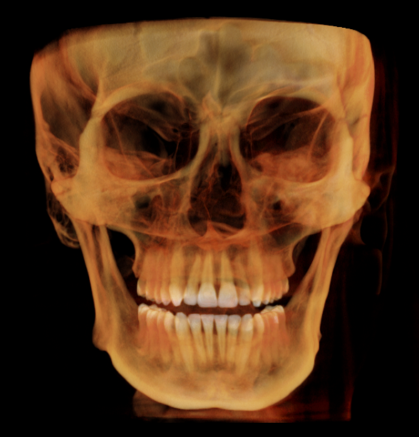 V18 Teeth view 1.png