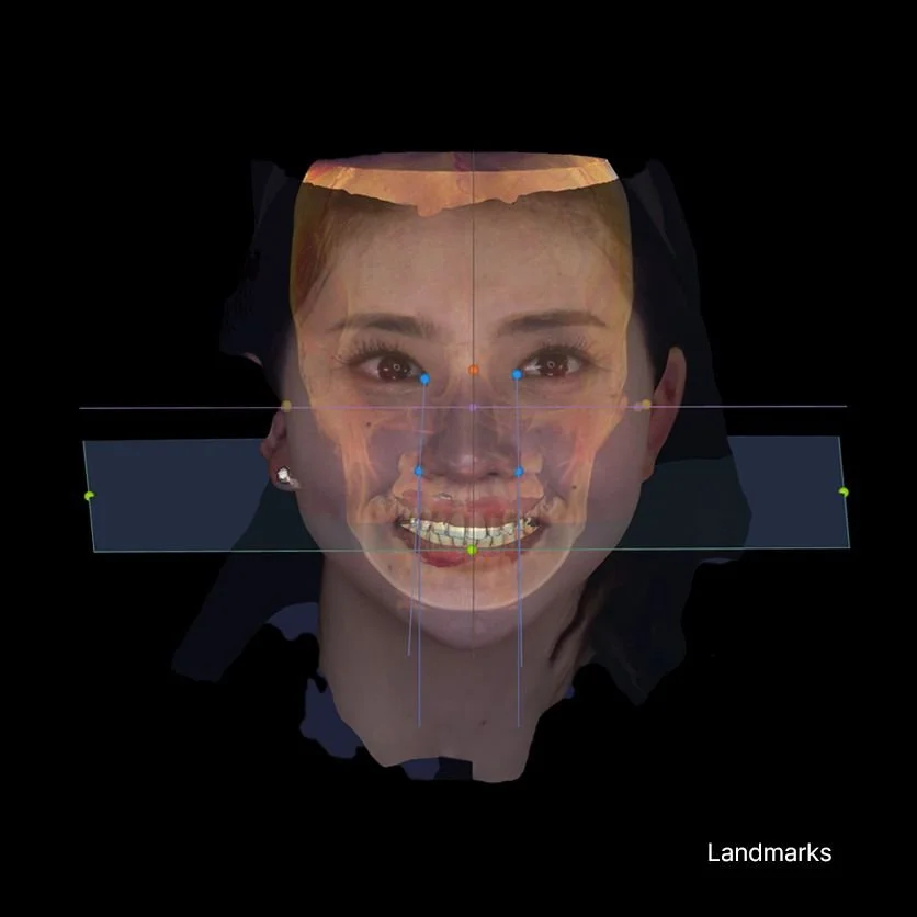 Rayface4.jpg