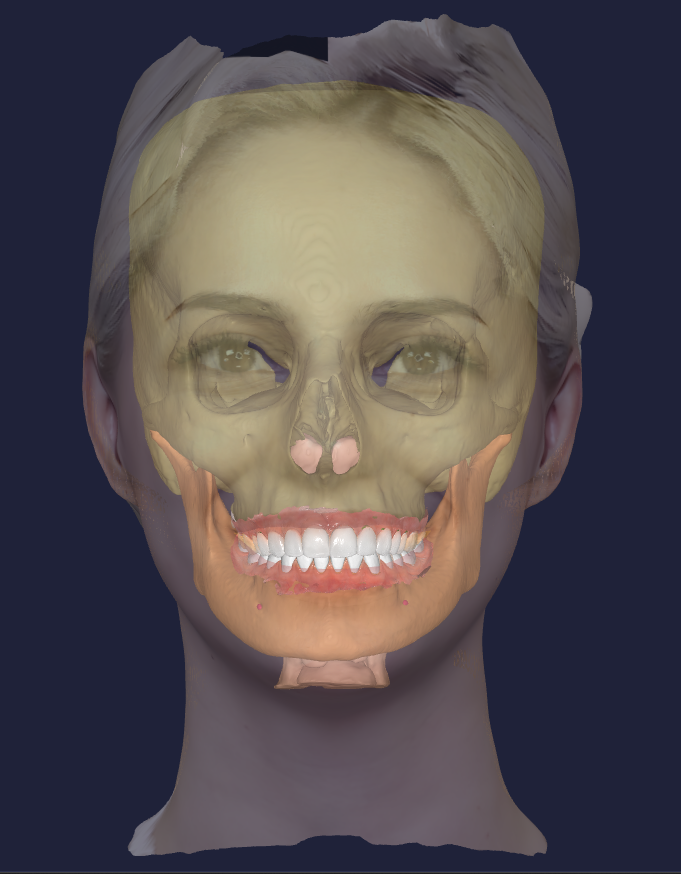 A digital illustration of a human face with an overlay of a skull, showing internal facial structures and teeth.