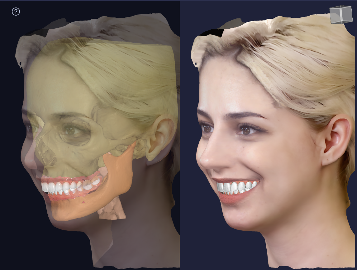 Comparison of a digital anatomical illustration of a woman's skull and teeth on the left with a photograph of a smiling woman on the right, illustrating the connection between skeletal structure and facial appearance.