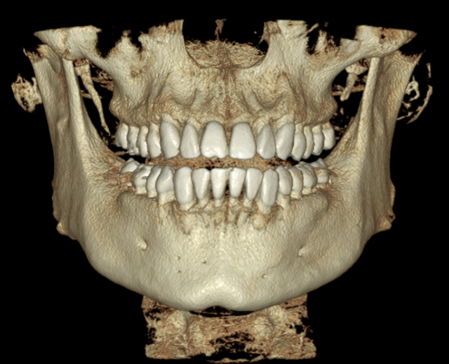 V16 Bone VR - 1 1.png