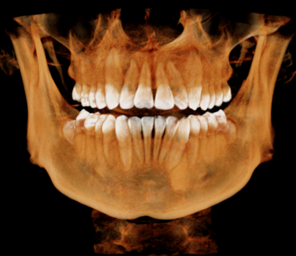 V16 Tooth VR -1 1.png