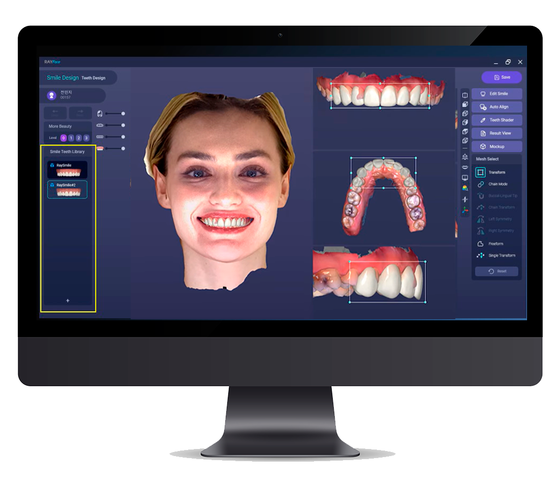 Computer screen displaying smile design software with a woman's face and digital 3D models of teeth and gums.