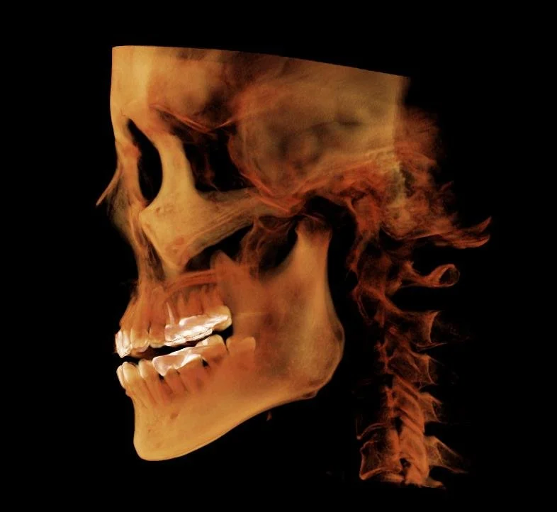 A 3D rendering of a human skull in profile with visible teeth and jaw, depicted in warm, fiery tones against a black background.