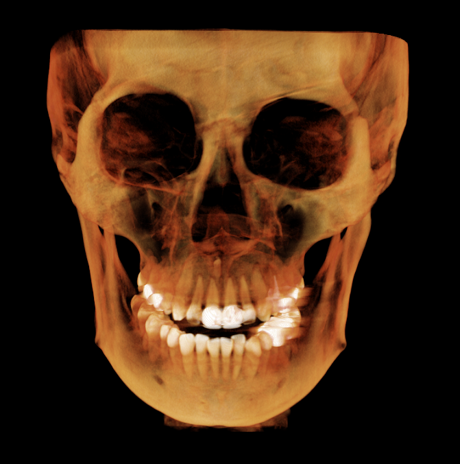 A 3D rendering of a human skull with detailed features against a black background.