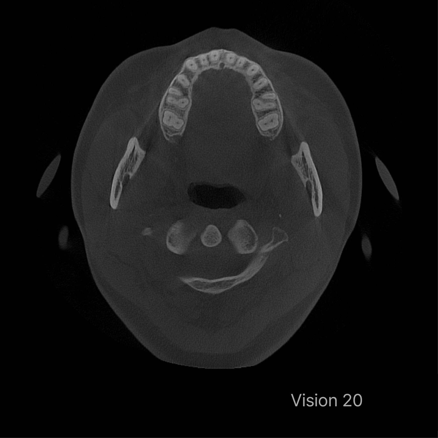 Vision 20-pic1.png