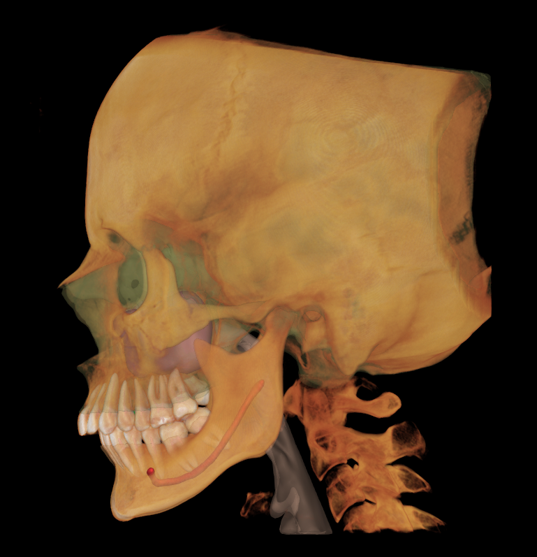 A lateral view of a human skull with some overlay of internal structures, showing the skull, jaw, and cervical vertebrae.