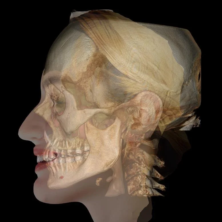 A composite image of a woman's face and a human skeleton side by side, highlighting anatomical features.
