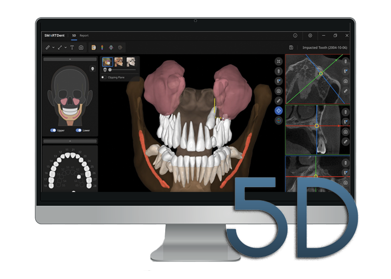3D dental imaging software on a computer screen showing a detailed 3D model of teeth, gums, and jaw structure with measurements and analysis tools.