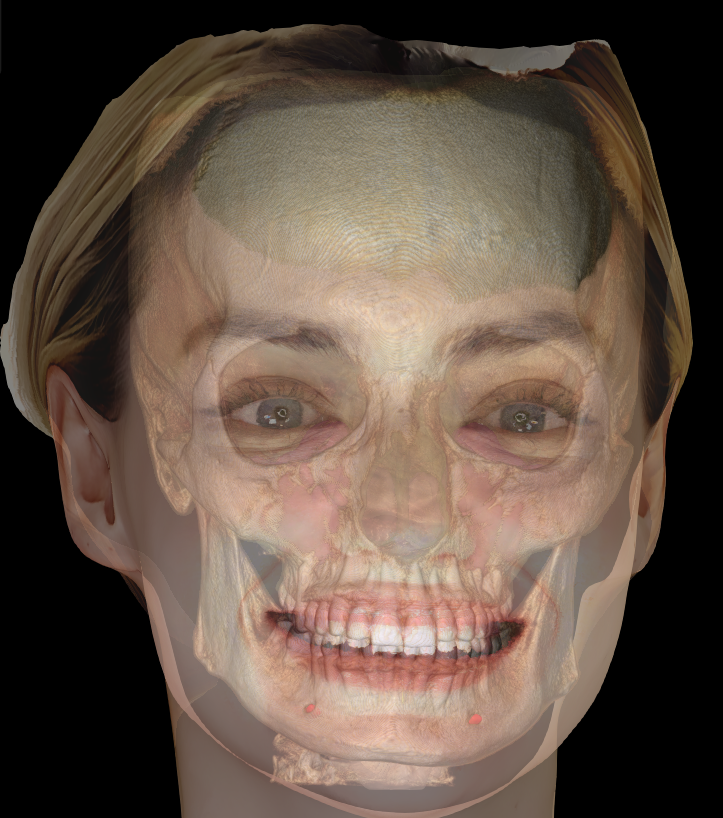 A digitally created, surreal image combining a woman's face with a human skull underneath, showing teeth and facial features overlaid.
