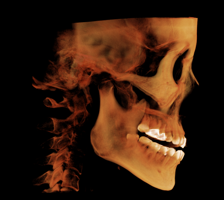 A side view of a human skull with a Smokey effect and orange lighting, set against a black background.