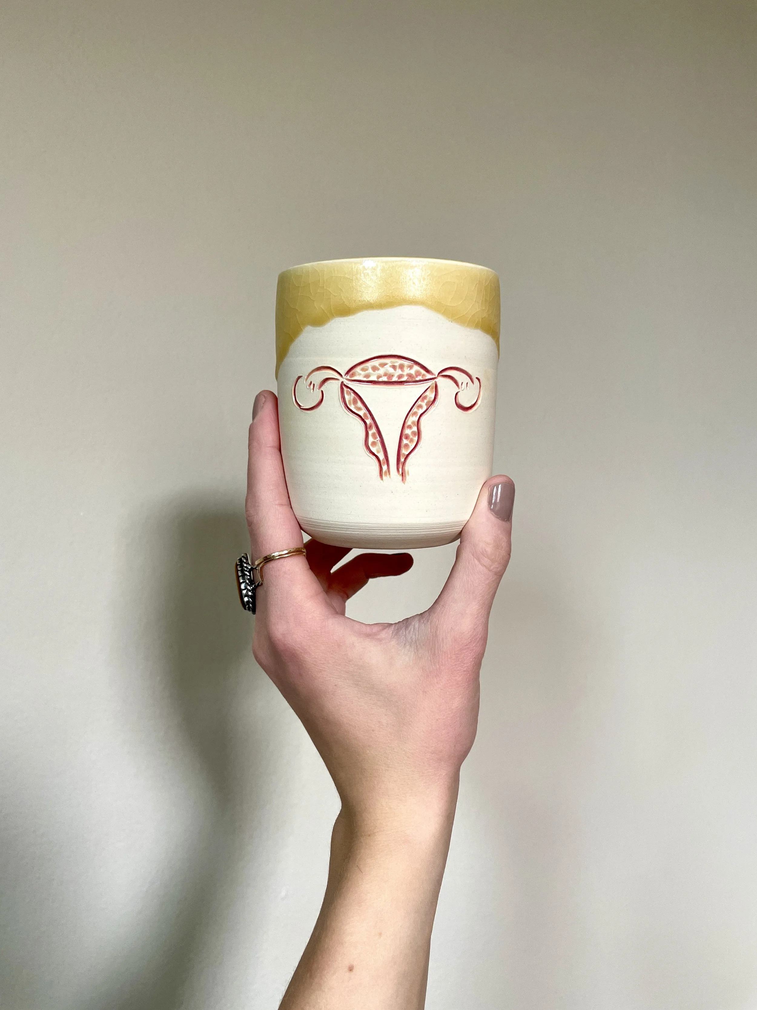 uterus cup