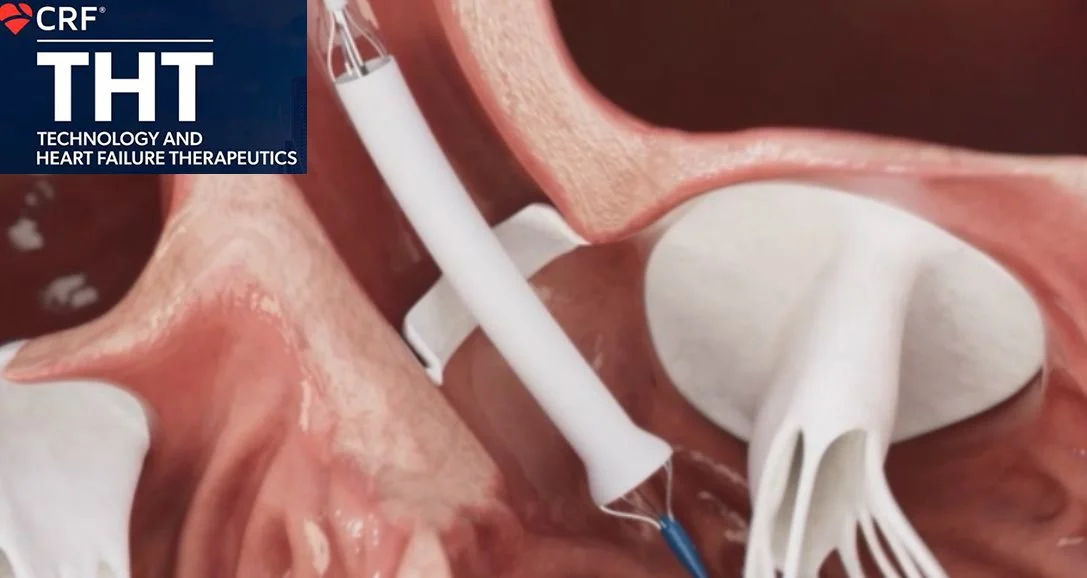 VenstraMedical THT presenter