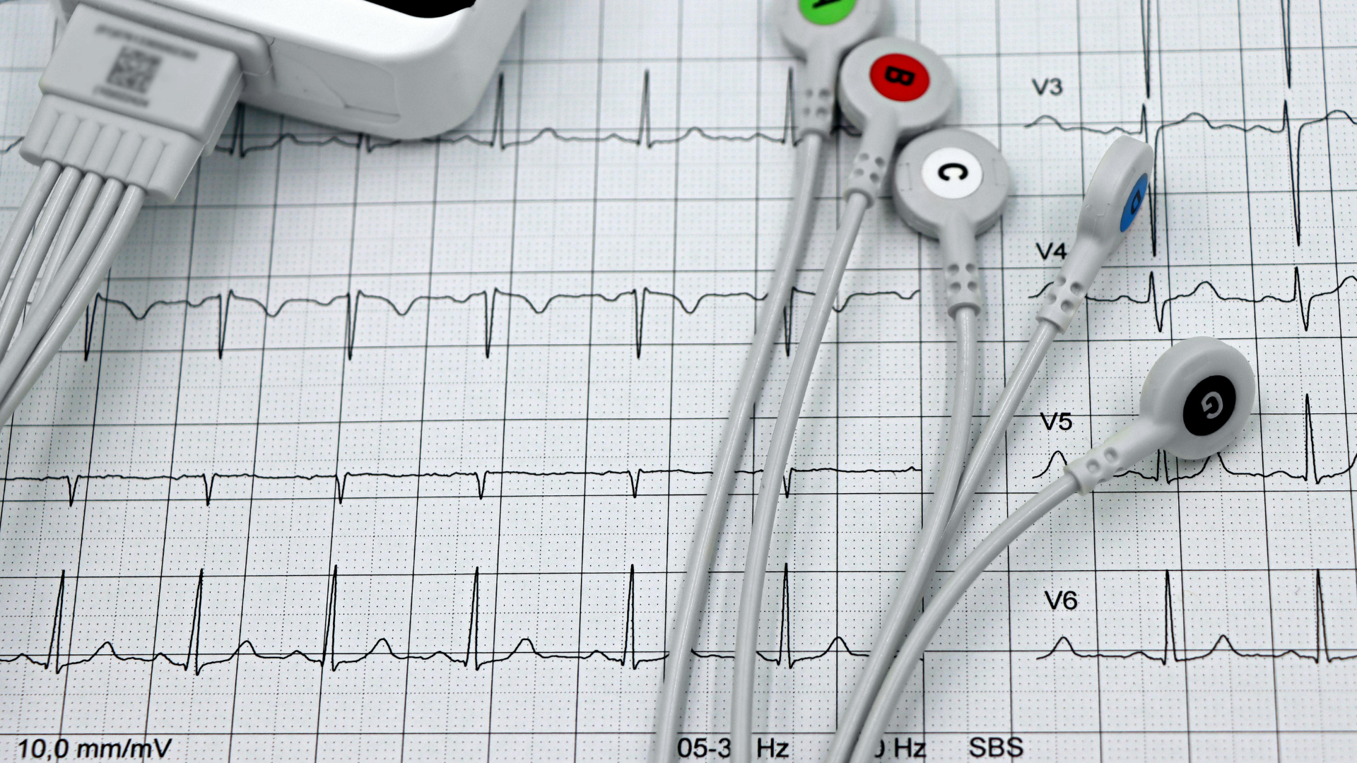 What Is a 12-Lead EKG? A Tech Explains What Those Stickers Are Doing