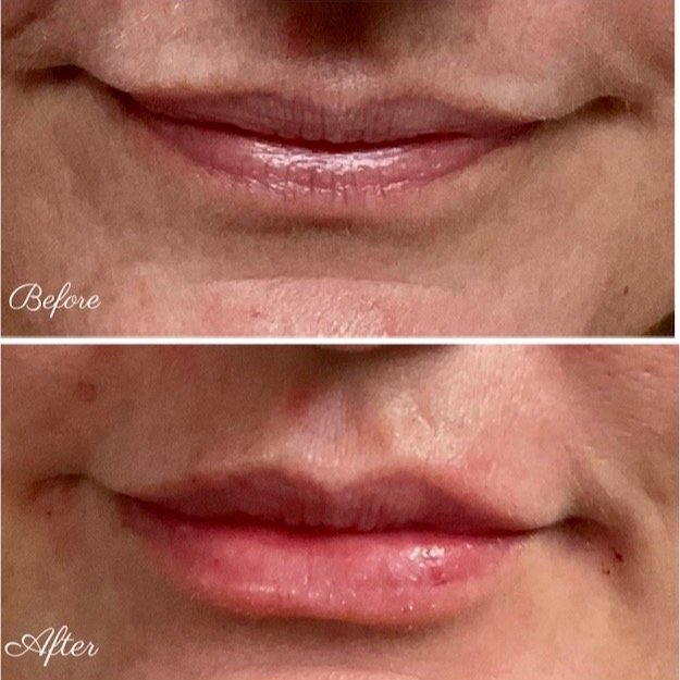 lips edit.jpg