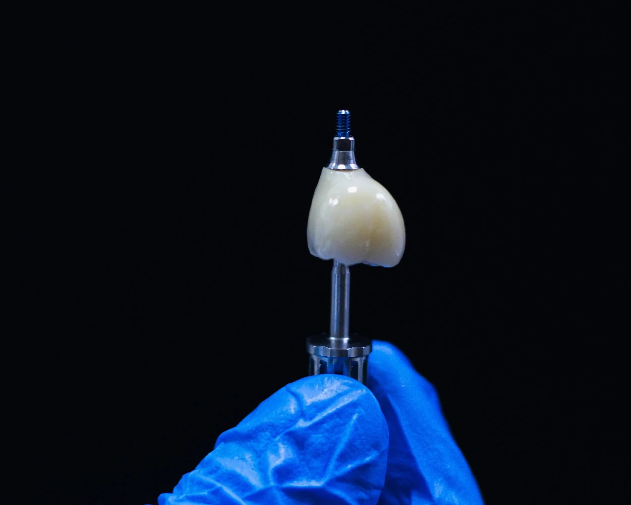 Implant dentar: cum funcționează, cât costă și cât durează tratamentul