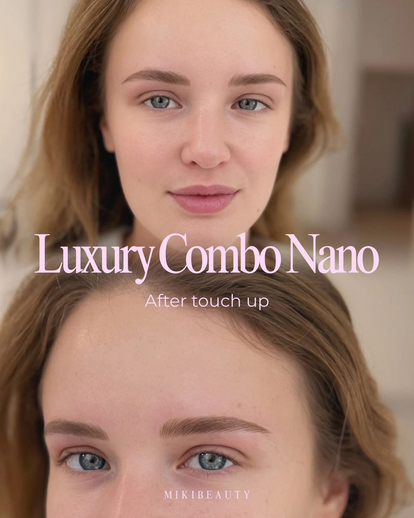 /
・Initial Treatment (photo2)💛
This is the result immediately after the first session.
At this stage, the color may appear slightly deeper than the healed result.

As the skin recovers, the pigment softens and settles naturally, revealing a more ref