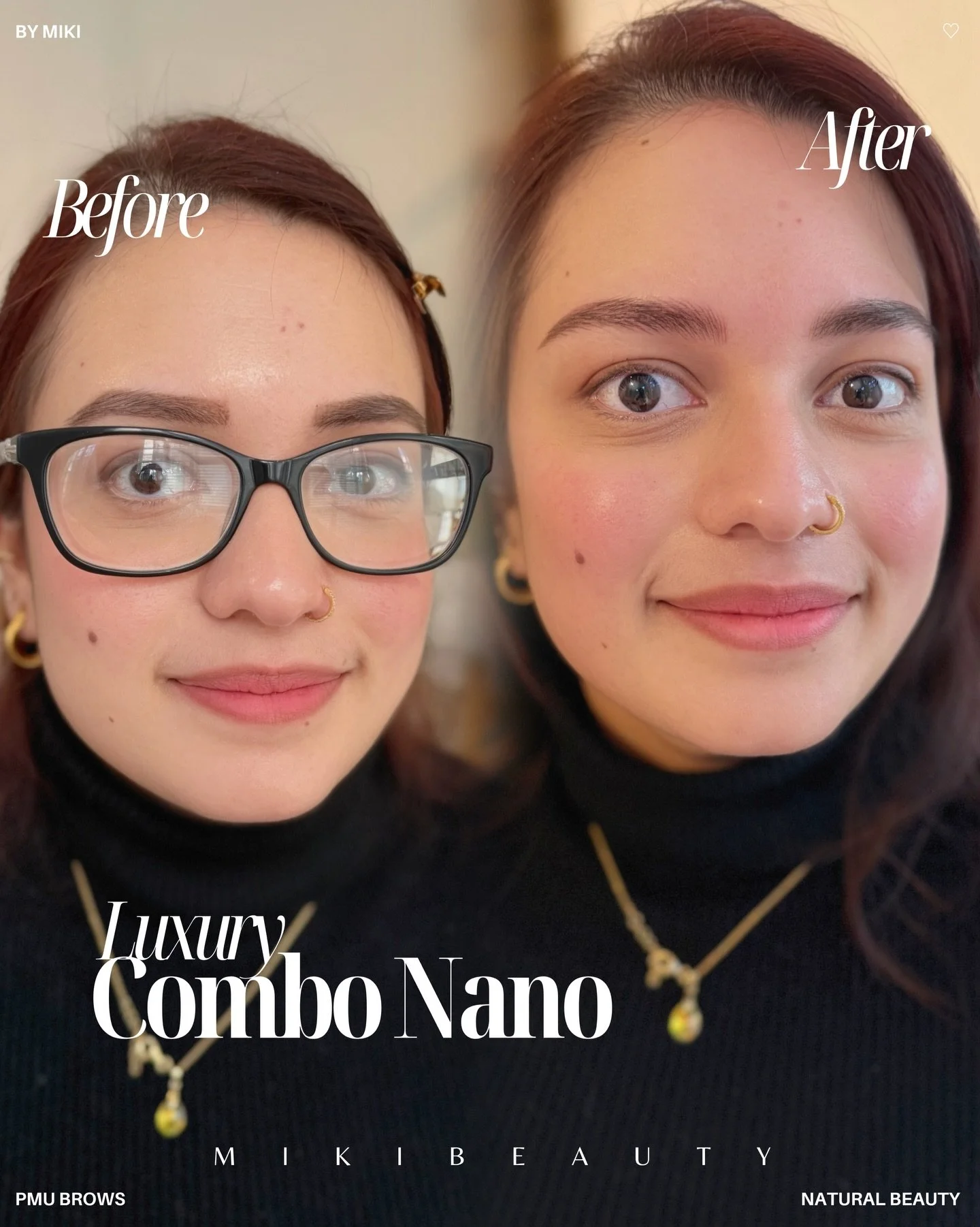 /
⚫︎Why the Touch-Up Is So Important

A touch-up session is possible from 4 weeks after your initial treatment.
Ideally, I recommend returning within 4&ndash;6 weeks.

The first treatment is not considered a completed result.

In almost all cases, a 