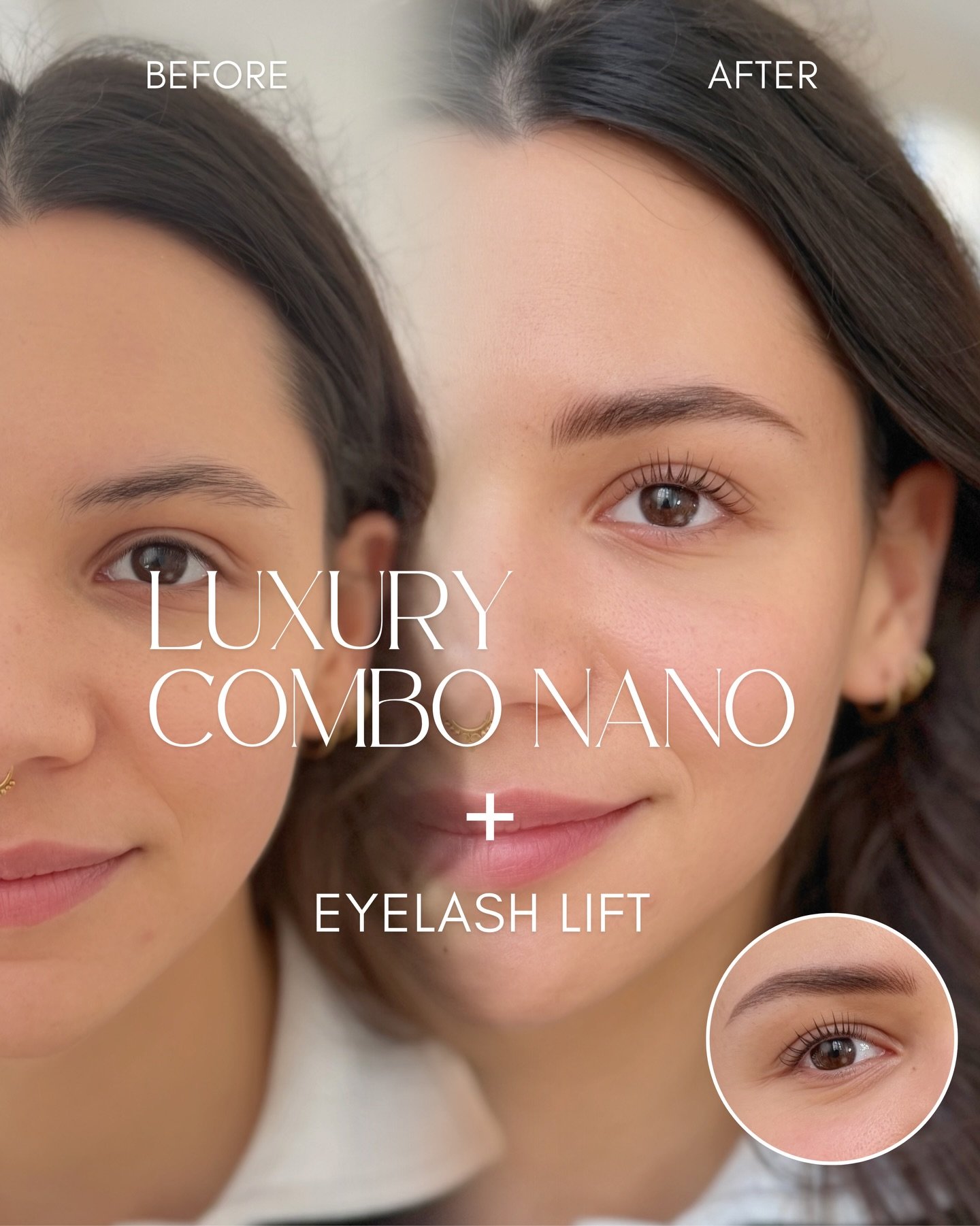 /
Luxury Combo Nano➕Eyelash Lift 🟰😍❤️

A soft, natural transformation&mdash;designed to enhance your features, not overpower them.
Perfectly balanced brows paired with a lifted, open eye look✨

Both PMU eyebrows and an eyelash lift can be done on t