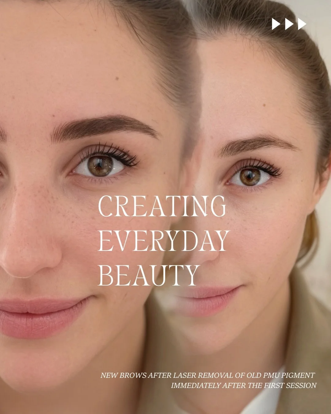/
Inner and outer beauty is created through the way you care for yourself every day.

Pilates🧘🏻&zwj;♀️
Waking up early⏰✨
Skincare🧖🏼&zwj;♀️🌞🌛
Prioritizing your health🥗🍴
Protecting your peace and time📖🛁
Daily effort🚴🏽&zwj;♀️🌬️
Never stoppi