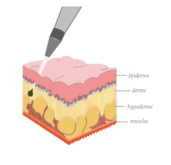 Cours 9 : Processus dermal du tatouage