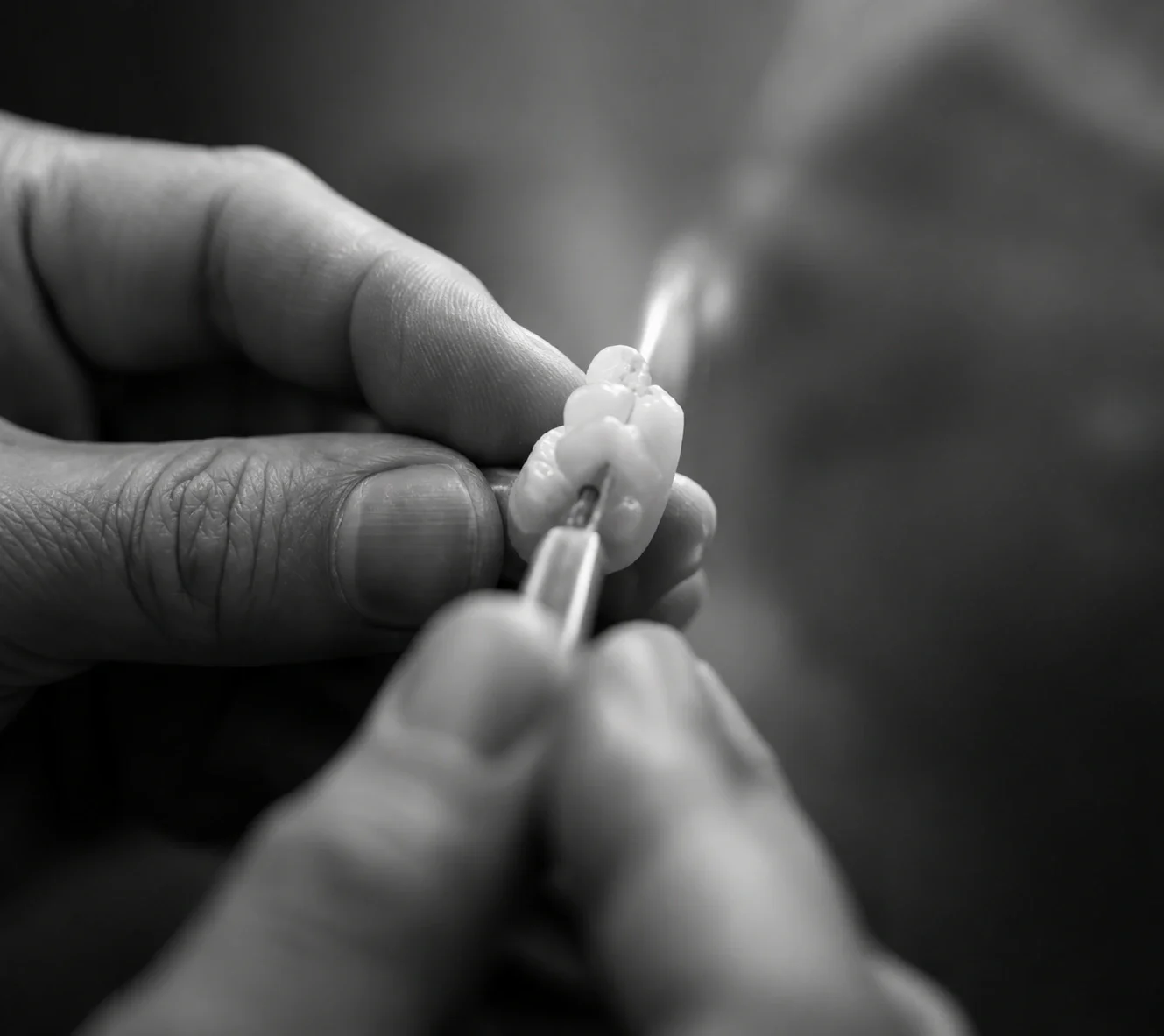 Close-up of a person's hand holding a dental tool working on a tooth with dental filling or restoration.