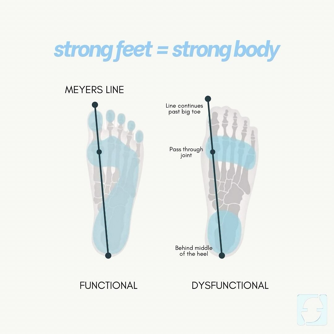 when we cram our feet into narrow shoes for years, the alignment of the big toe (meyer&rsquo;s line) is disrupted, leading to significant consequences like bunions, foot pain, reduced mobility &amp; potential issues throughout the entire kinetic chai