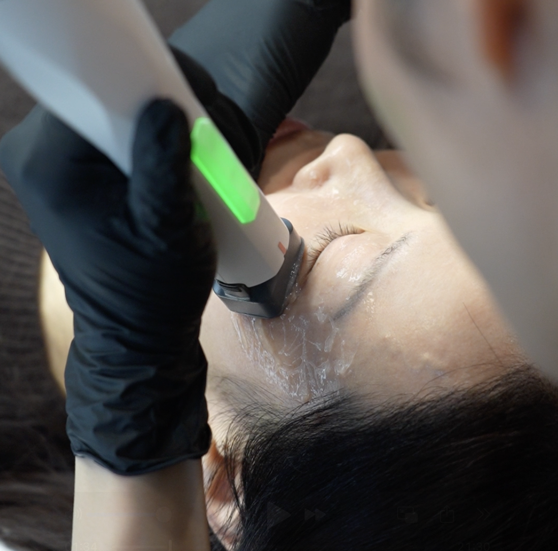 Client receiving a XERF structural skin tightening treatment