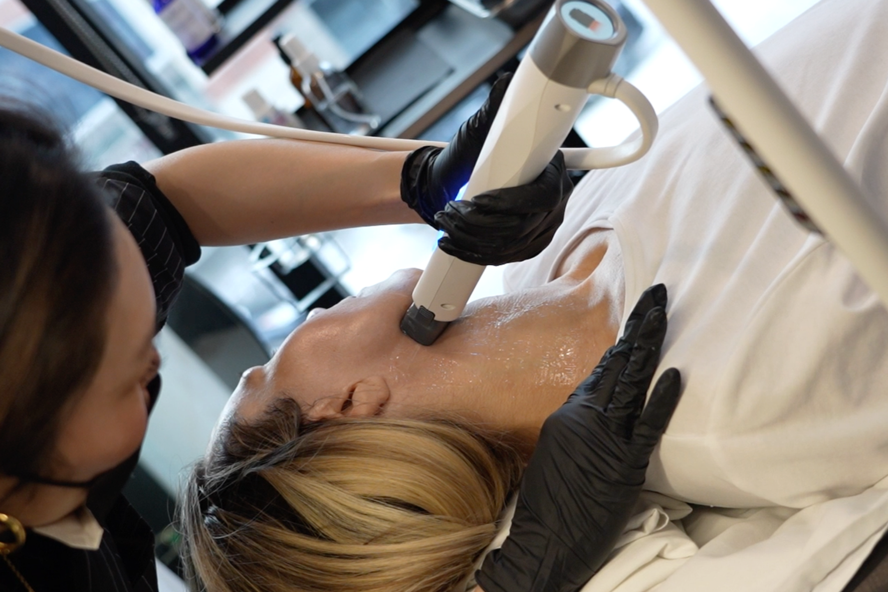XERF lower face treatment