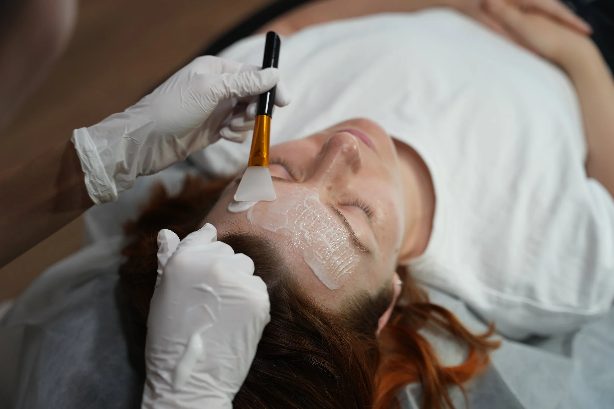 2.Skyns Skin Rejuvenation Treatment Calgary.JPG