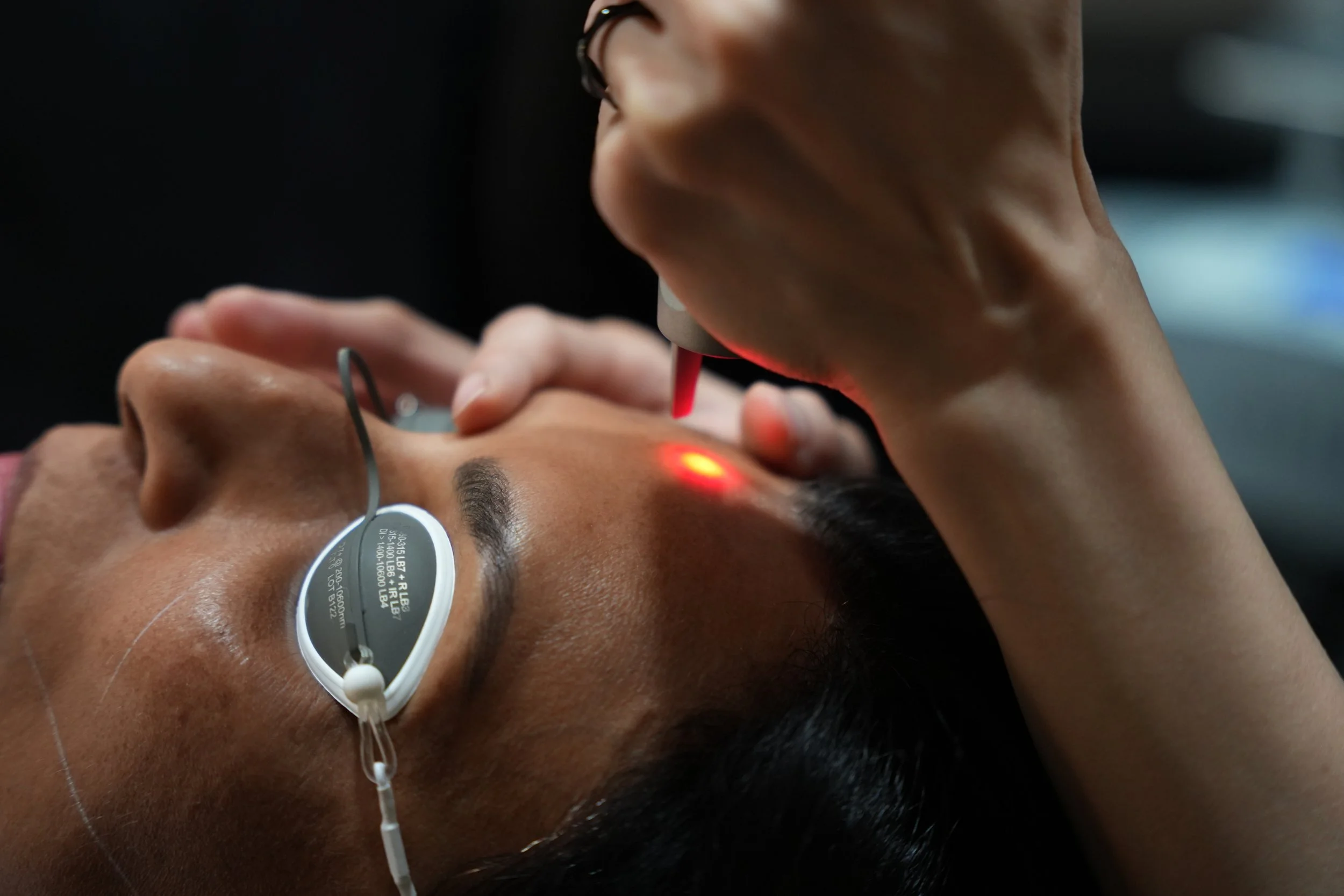 PicoSure Pro laser skin rejuvenation treatment for pigmentation and skin texture at SKYNS Calgary