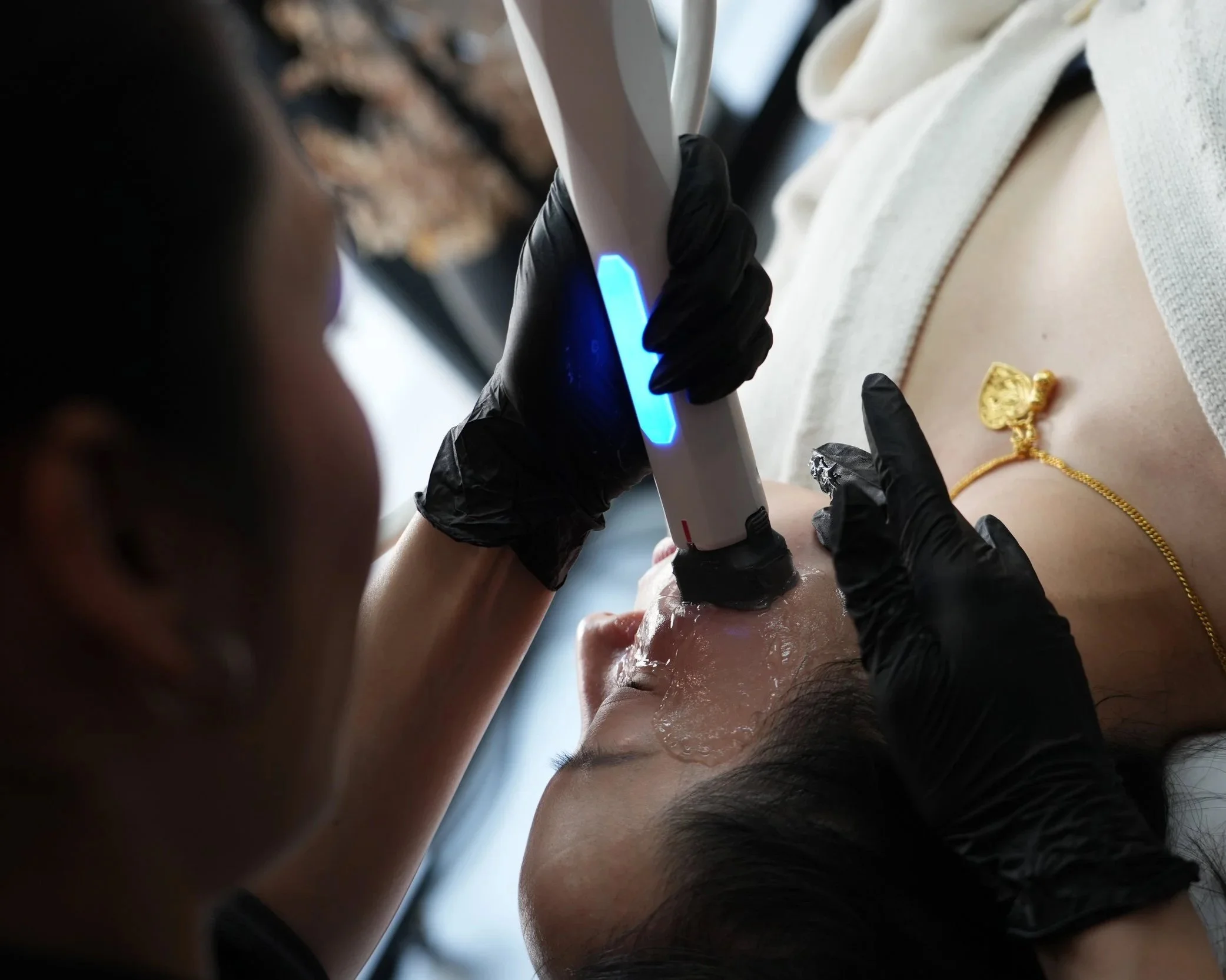 Client receiving a XERF structural skin tightening treatment at SKYNS laser and skin clinic in Calgary.