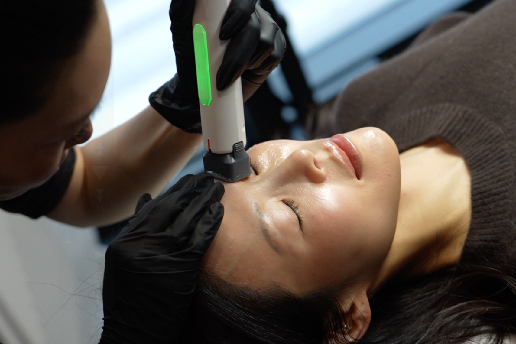 Client receiving a XERF structural skin tightening treatment at SKYNS in Calgary