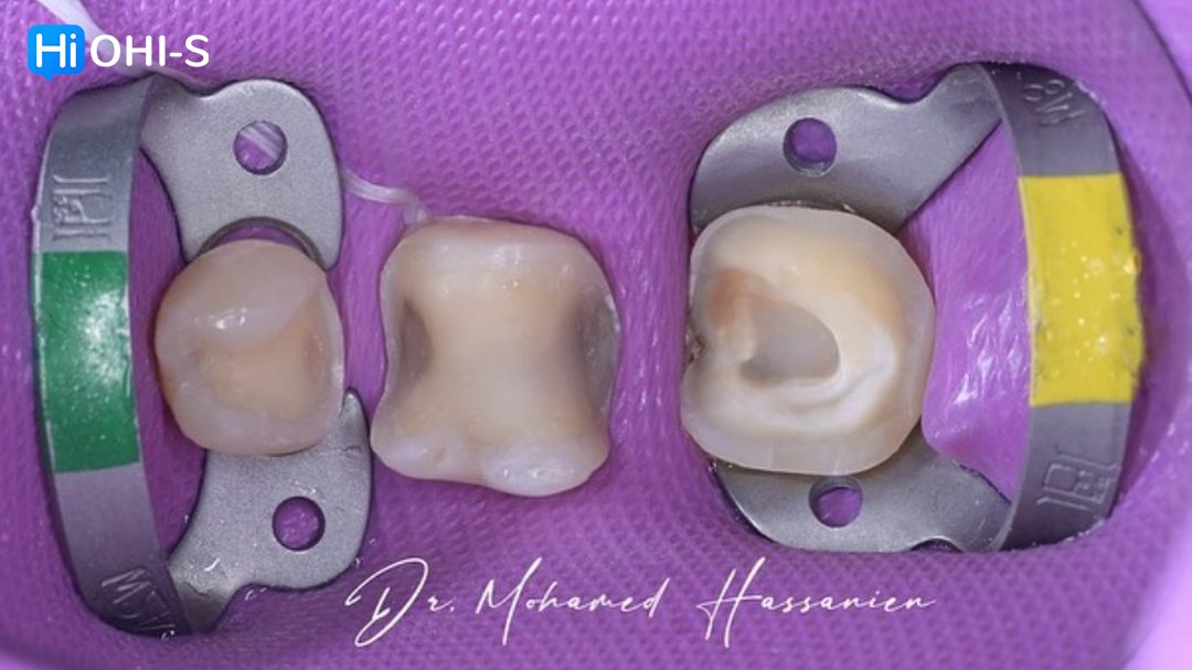 Complete Prosthetic Protocols CAD CAM CEREC 5.jpg