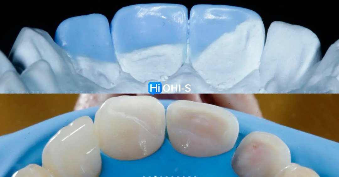 International schools working with composite restorations 3.jpg